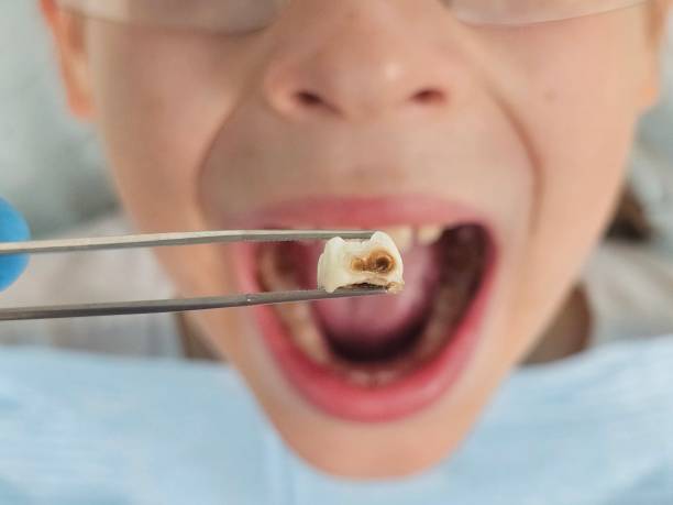 Best Emergency Treatment for Toothache in Salt Creek Commons, IN