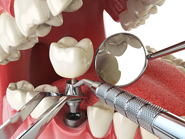 Best Walk-In Emergency Dentist in Salt Creek Commons, IN