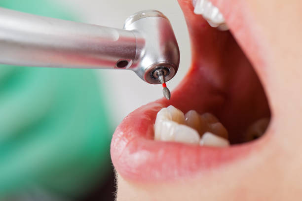 Best Emergency Broken Tooth Repair in Salt Creek Commons, IN